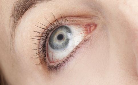 眼睛散光怎么辦 眼睛散光 眼鏡矯正 輕度散光 眼睛散光的原因