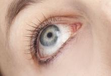 倒春寒 需謹(jǐn)防三種眼病