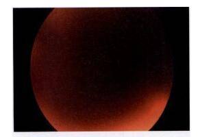 視力快速下降的原因有這么多，你知道嗎？