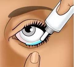 點眼藥水的正確步驟和姿勢 點眼藥水的正確步驟和姿勢