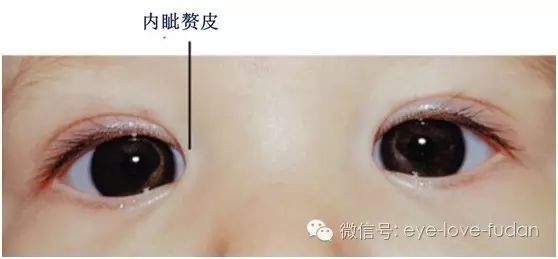 關于眼健康的傳言與真相 關于眼健康的傳言與真相