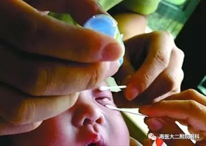 頻繁眨眼，小心是眼病信號