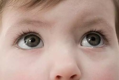 干眼癥是眼病嗎？可以治療嗎？