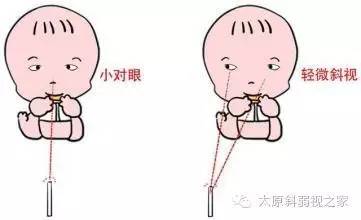 寶寶的視力發(fā)育過程及檢查方法