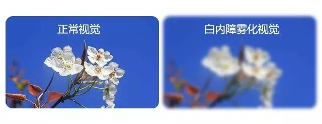 中老年人患白內障的真相是什么? 中老年人患白內障的真相是什么?