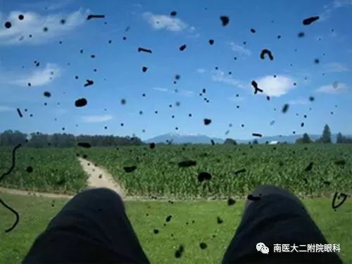 高度近視患者注意六大事項 高度近視患者注意六大事項