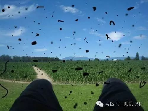 視網膜脫落的癥狀有哪些? 視網膜脫落的癥狀有哪些?