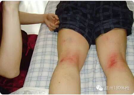 用你的雙手拍去你的疾病，簡單實用！