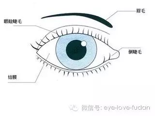 倒睫是怎么回事?自己可以用鑷子拔嗎? 倒睫是怎么回事?自己可以用鑷子拔嗎?