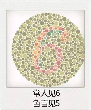 與視力相關(guān)的一些眼疾