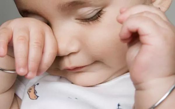 眼分泌物多是病嗎？