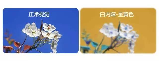 中老年人患白內障的真相是什么? 中老年人患白內障的真相是什么?