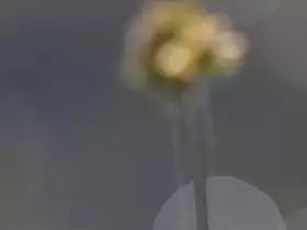 白內障初期的六大警報，五類高發人群