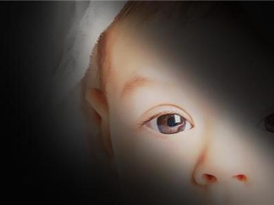 如何有效預防寶寶斜視？