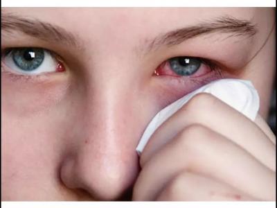 寶寶眼睛紅，是紅眼病嗎？