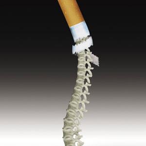 吸煙竟會(huì)引起弱視？