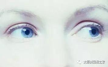 轉(zhuǎn)眼珠能提高記憶力？還改善視力？