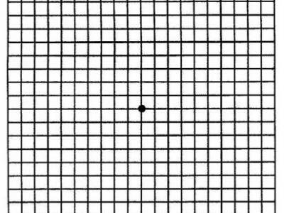 什么是阿姆斯勒表？如何使用？