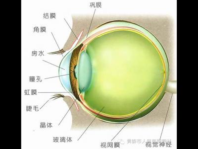 眼科科普，關(guān)于青光眼那些事兒
