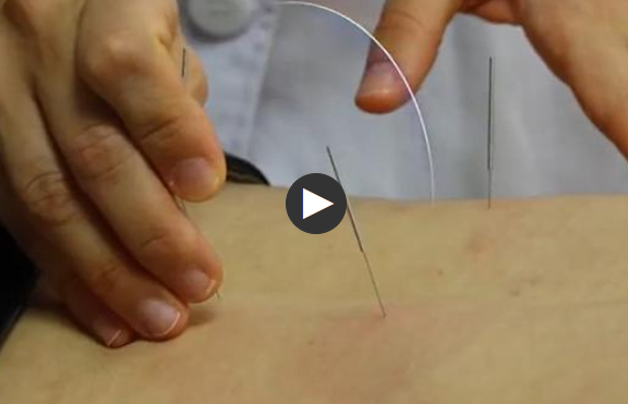 12名葡萄牙“洋中醫(yī)”江西進(jìn)修，“解鎖”中醫(yī)新技法