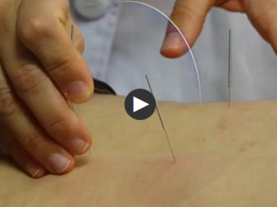 12名葡萄牙“洋中醫”江西進修，“解鎖”中醫新技法