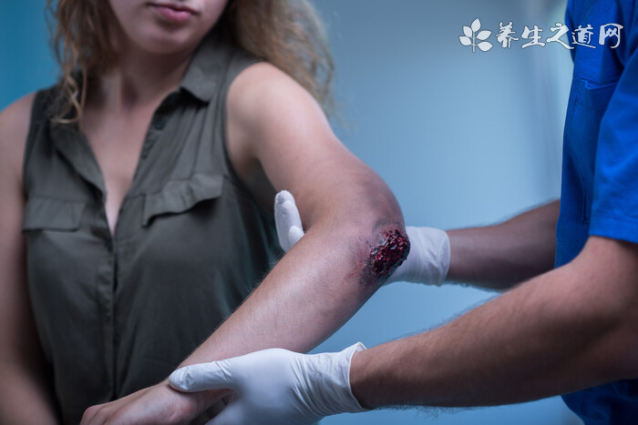 哪些病不適合針灸