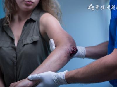 哪些病不適合針灸