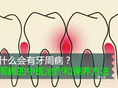 為什么會有牙周??？牙周病的中醫(yī)治療和保養(yǎng)方法