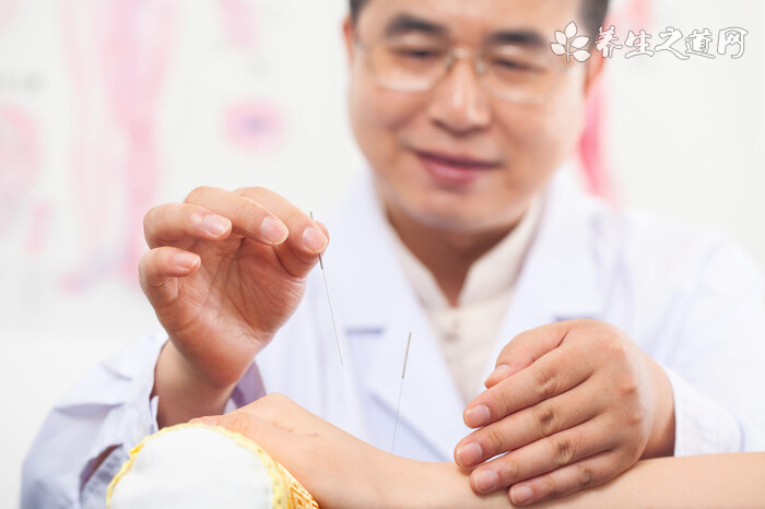 沒病可以針灸調理嗎