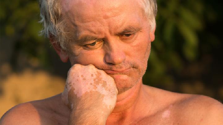 中醫針灸會不會疼? 這4種人不適合做針灸