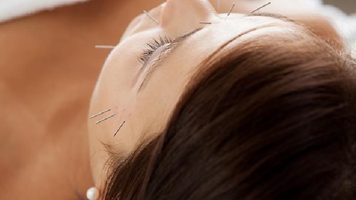 紫外線照射易致眼角長(zhǎng)雀斑 中醫(yī)三種針灸療法治眼角雀斑效果好