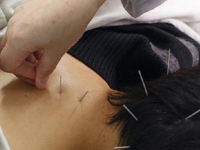 青少年近視眼如何治愈 中醫針灸治療近視眼的三療法