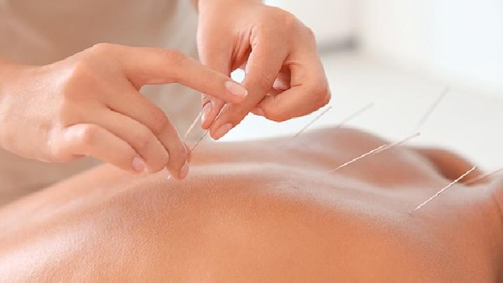 中醫針灸常見的4種好處須知 這7類人針灸需注意