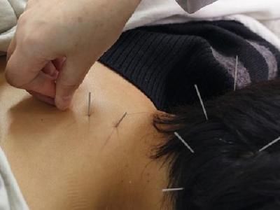 日常生活中應(yīng)該如何診斷色盲 中醫(yī)針灸可以有效治療色盲