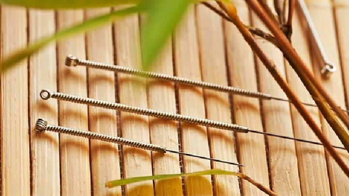 治療耳鳴用的針灸方法是怎樣的 專家解讀中醫針灸治耳鳴的方法