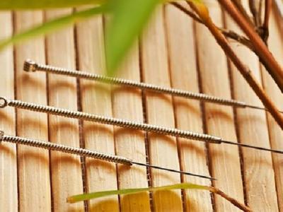 治療耳鳴用的針灸方法是怎樣的 專家解讀中醫針灸治耳鳴的方法