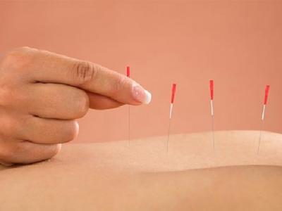 視神經萎縮的針灸治療方法是什么 中醫針灸治療視神經萎縮的方法