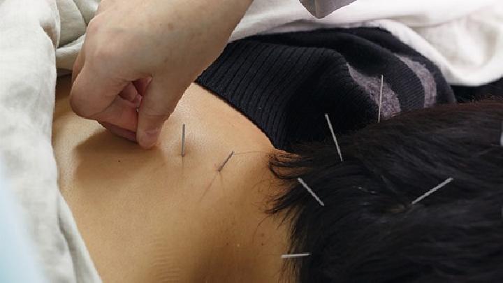 中醫(yī)針灸治療耳鳴癥狀有效嗎 中醫(yī)治療耳鳴所用的針灸方法解讀