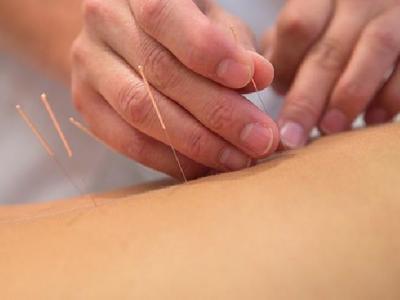 煩人鼻炎怎么治療才能康復 中醫針灸治療鼻炎的四個方面