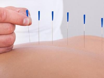 中醫治療耳鳴用的針灸方法是什么 中醫針灸治療耳鳴的3個方法