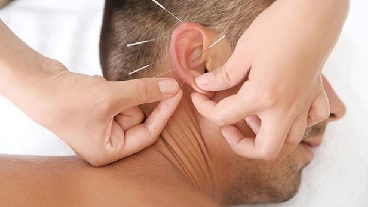 中醫怎么運用穴位針灸治療痤瘡 中醫針灸治療痤瘡的兩個方面