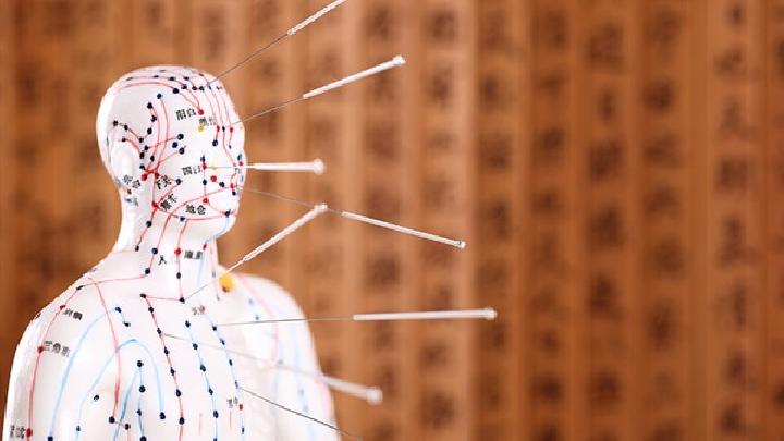 女性閉經的癥狀有哪些女性遠離閉經試試針灸療法