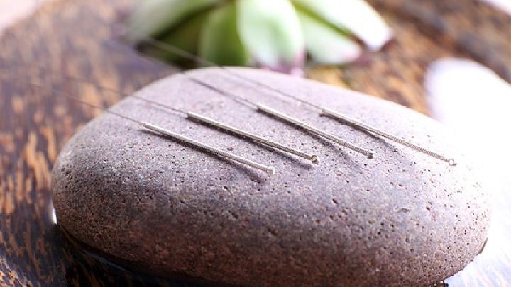 針灸對(duì)痤瘡的治療有效果嗎？中醫(yī)針灸的去痘方案介紹