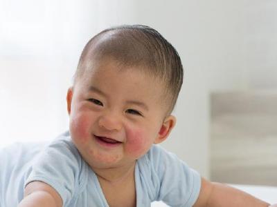 當孩子咳嗽時父母應該怎么做？孩子咳嗽可以試試小兒推拿