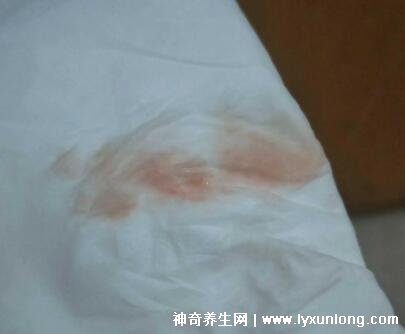 益母草是墮胎滑胎最兇的食物，誤服致胎兒畸形(大劑量的副作用)