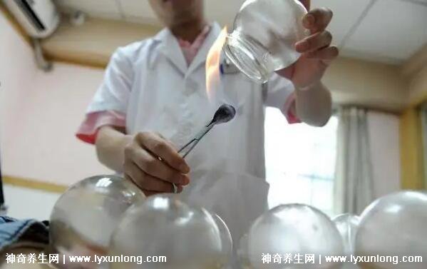 拔罐顏色癥狀對照表圖解，深淺代表不同病癥(越淺越好)