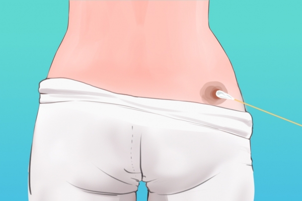 蒲團坐灸的危害