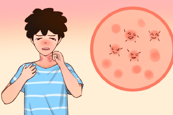 濕疹用忍冬藤泡澡管用嗎?