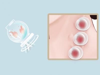 拔罐后多久可以吹空調(diào)