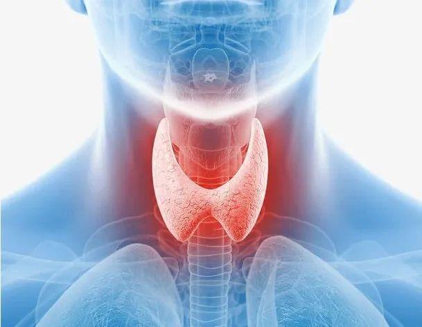 南寧中南甲狀腺醫(yī)院樊春聚醫(yī)生：甲狀腺結(jié)節(jié)偏愛(ài)哪些人？一旦查出，你該如何應(yīng)對(duì)